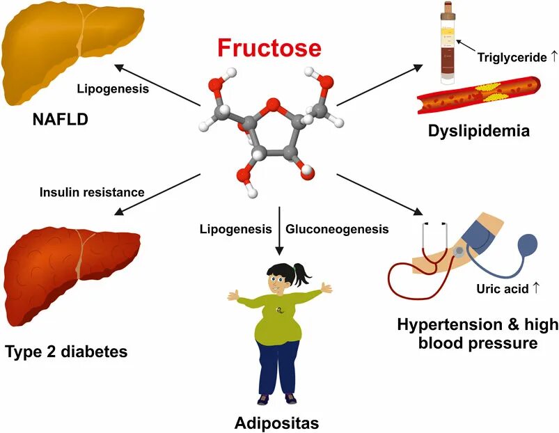Метаболизм фруктозы в печени. Фруктоза и печень. Метаболизм фруктозы в организме. Фруктоза влияет на печень.