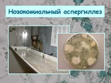 Аспергиллез лечение