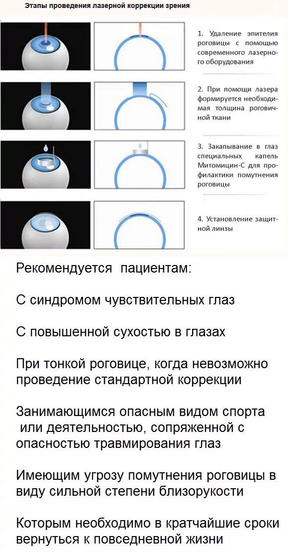 Восстановление после лазерной операции. Лазерная коррекция зрения схема операции. Ограничения после лазерной коррекции зрения. Основные этапы лазерной коррекции зрения. Ограничения после лазерной коррекции.