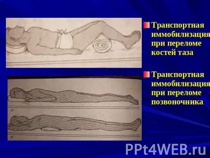 Перелом позвоночника форум