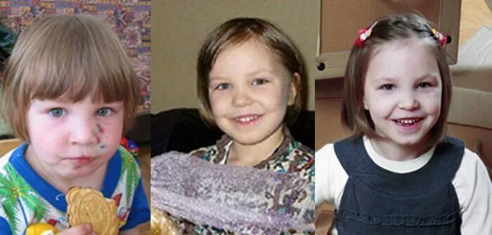 Дети до и после усыновления. Фото детей до и после усыновления. Девочки из детского дома. Дети из детдома до и после.