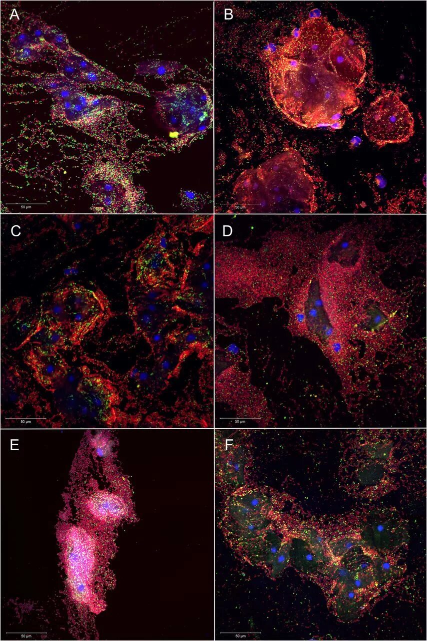 Атопобиум вагинае. Энтерококки ферментируют. Атопобиум мазок. Атопобиум вагиналис что это. Бактериальный вагиноз atopobium vaginae.