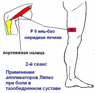 Бедро болит в состоянии покоя