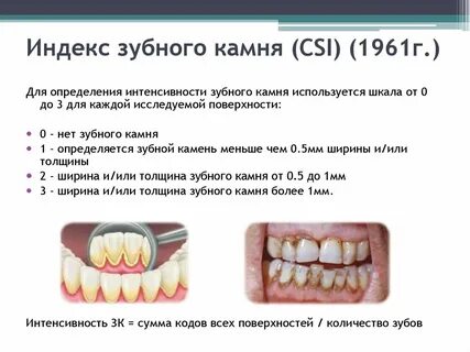 Зуб образовать слова