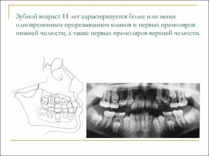 Зубной возраст