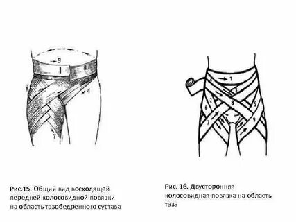 Тазобедренная повязка