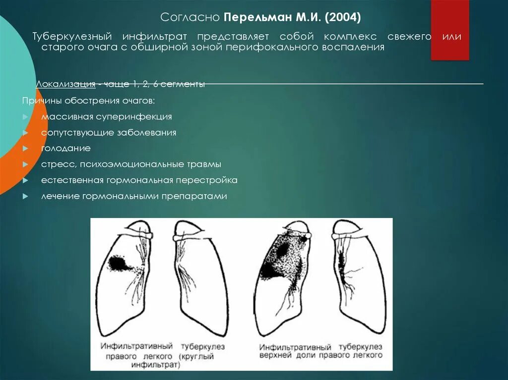 Без перифокальной реакции. Инфильтративный туберкулез презентация. Инфильтративный туберкулез причины. Перифокальный инфильтрат. Инфильтративный туберкулез легких презентация.