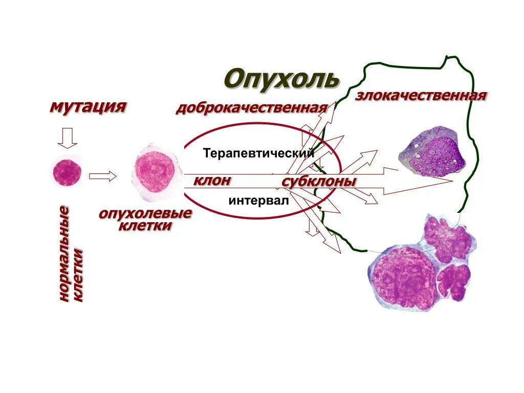 Клетка доброкачественной опухоли. Схема опухоль злокачественная и доброкачественная. Строение опухоли схема. Клетки доброкачественных опухолей. Доброкачественные и злокачественные новообразования.