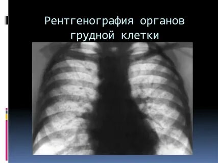 Ультразвуковое исследование органов грудной клетки