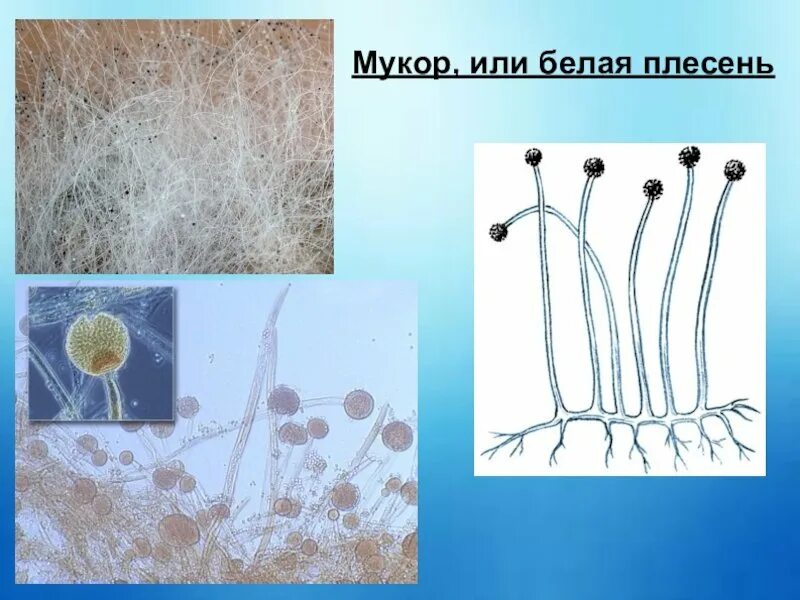 Признаки мукора. Строение плесени мукор. Плесневый гриб Mucor. Белая плесень мукор. Плесень ризопус (Rhizopus oligosporus).