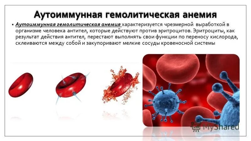 Гемолиз при аутоиммунная гемолитическая анемия. Аутоиммунная гемолитическая анемия патогенез. Тепловая аутоиммунная гемолитическая анемия. Механизм развития аутоиммунной гемолитической анемии.