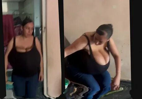 Slideshow janeth vizloc macromastia.