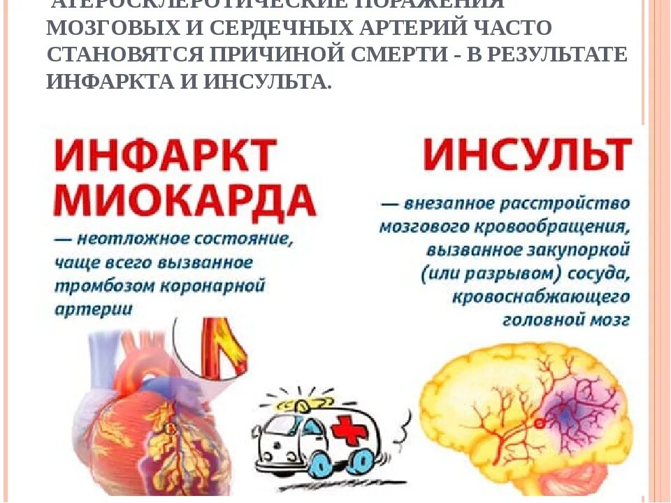 Чем отличается инфаркт головного мозга от инсульта. Инфаркт или инсульт сердца разница. инфаркт миокарда и инсульт отличия. инсульт и инфаркт. инфаркт и инсульт разница.