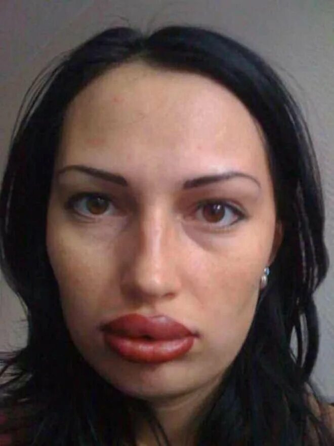 Силиконовые губы. Самые большие губы в мире. Некрасивые губы девушек. Накаченные губы некрасивые. Девчонки с большими губами.