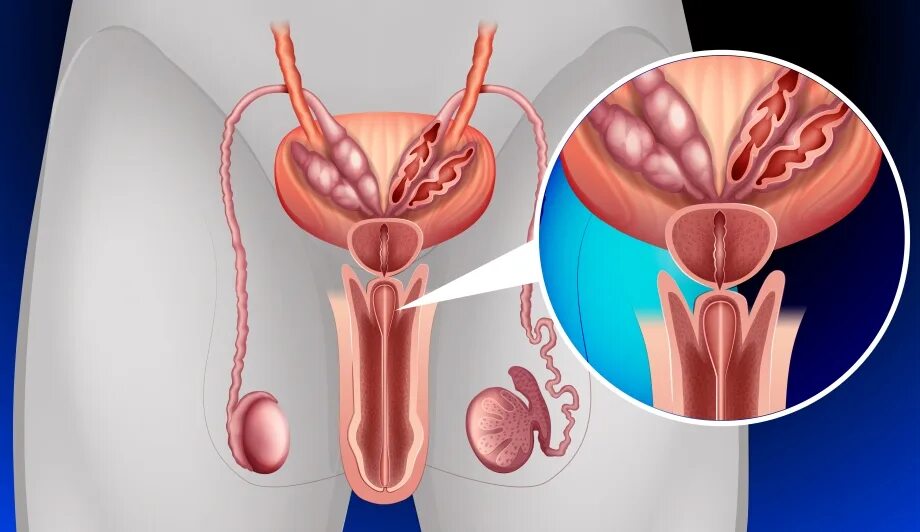 Предстательная железа у мужчин. Воспаление предстательной железы. Предстательная железа у женщин. Красивая простата