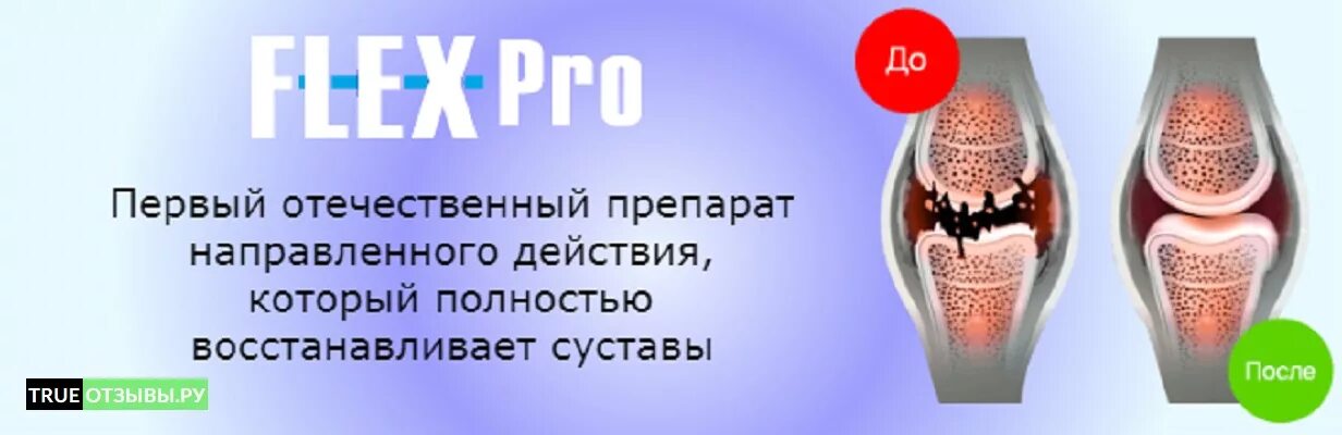 Флекс лекарство для суставов. Флекс таблетки. Флекс мазь. Препарат Flex для суставов.