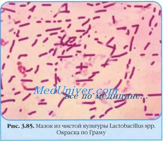 Lactobacillus spp у мужчин. Лактобактерии палочки Дедерлейна. Палочки Дедерлейна под микроскопом. Палочка Дедерлейна микробиология. Ацидофильные лактобактерии (Lactobacillus Acidophilus).