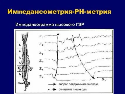 Импеданс рн метрия