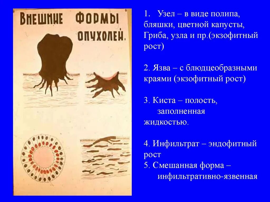 Рак определение термина