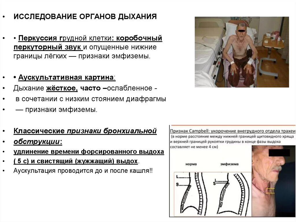 Коробочный звук при перкуссии легких бронхиальная астма. Перкуссия при эмфиземе легких. Звук перкуссии при бронхите. Эмфизема легких перкуторный звук.