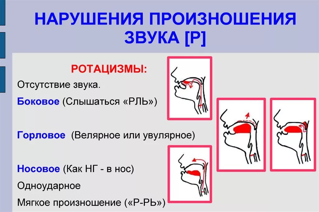 Нарушение произношения звука р. Произношение звуков. Нарушенное произношение звука р. Недостатки произношения звука р. Виды артикуляции