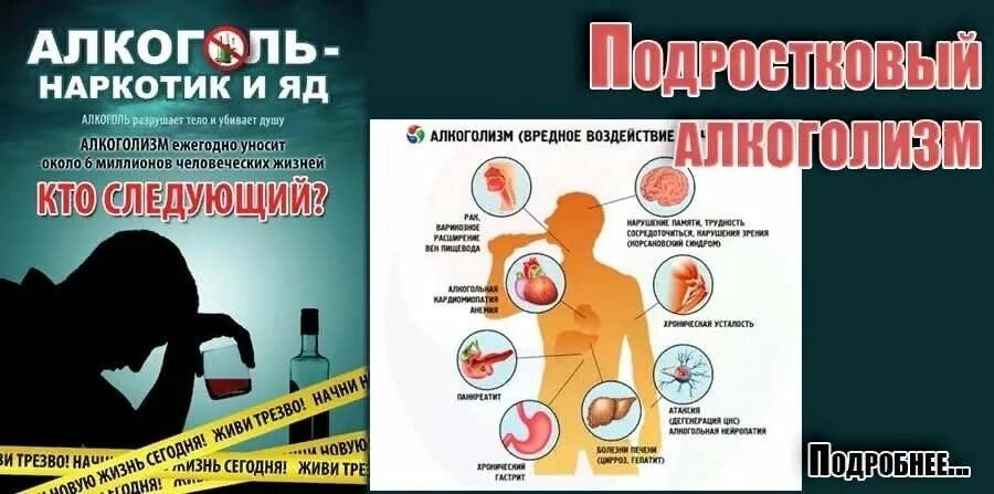 Профилактика подросткового алкоголизма. Алкоголь и подросток беседа. Беседа подростковый алкоголизм. Подростковый пивной алкоголизм. Как справиться с алкоголем