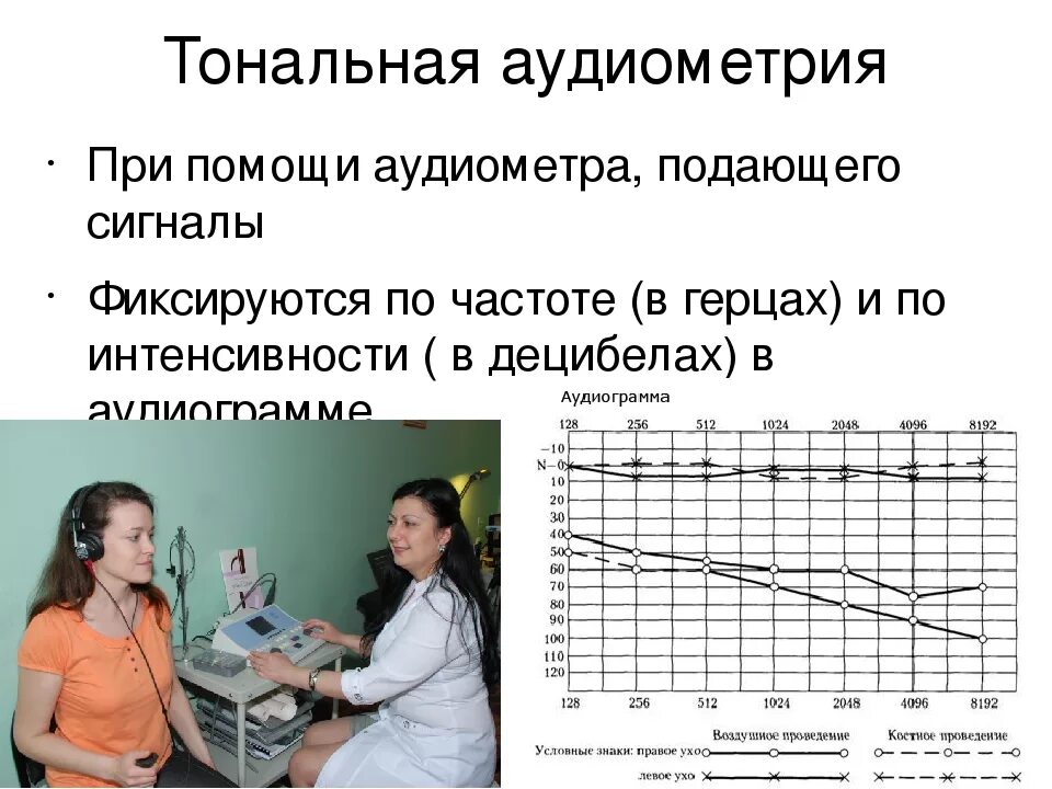 Аудиограмма ребенку. Тональная пороговая аудиометрия норма. Аудиометрия является методом исследования. Аудиометрия слуха норма у детей. Исследование слуха у детей аудиометрия аудиограммы.