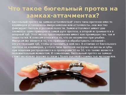 Бюгельное этапы