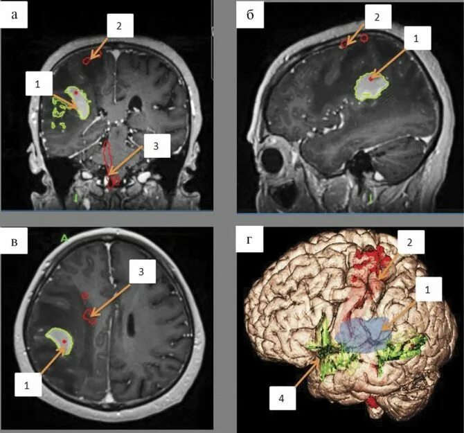 Доли мозга мрт. Анатомия мозолистого тела головного мозга мрт. Мрт снимок мозга. Опухоль головного мозга снимок мрт. Снимки мрт головного мозга с контрастом.
