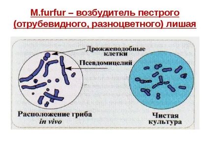 Покажите возбудитель