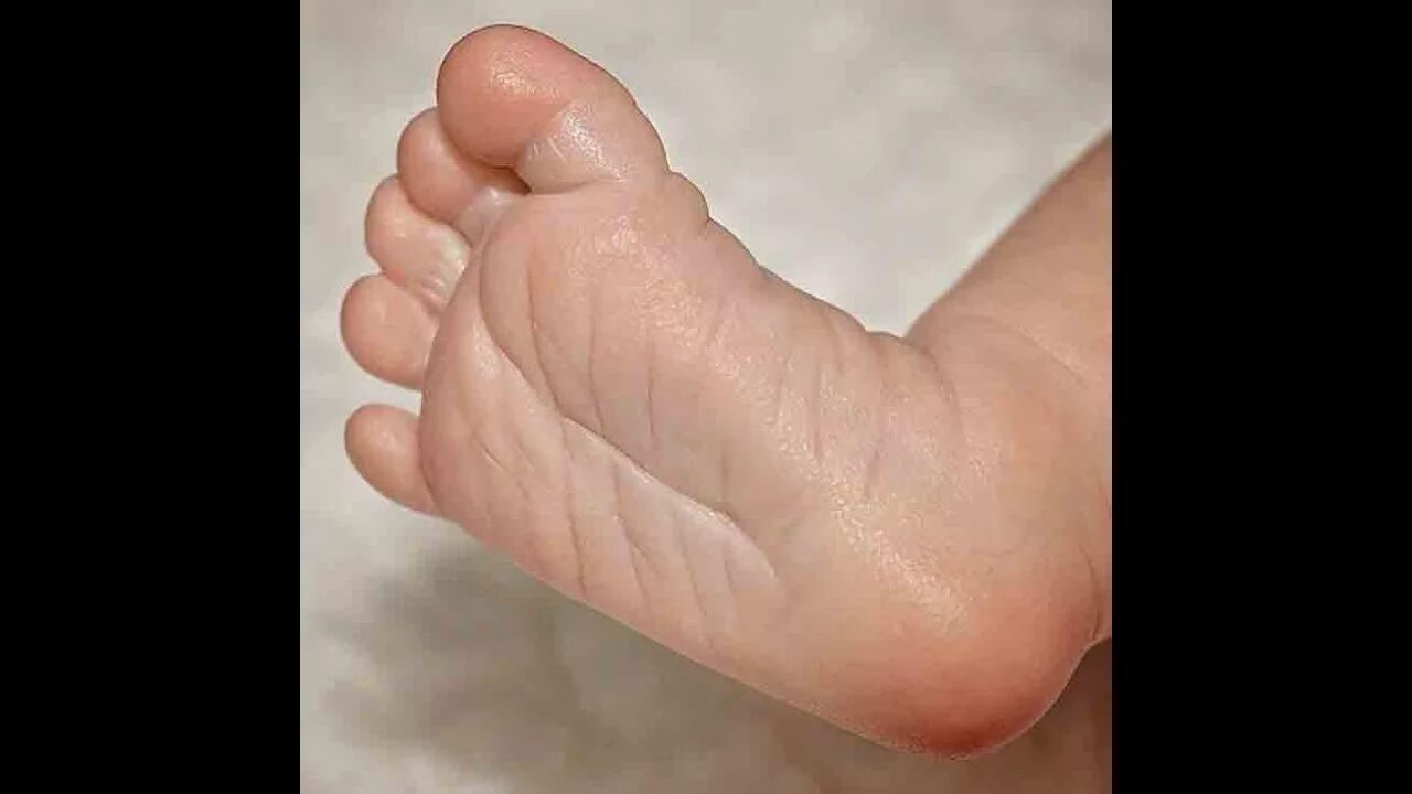 Рук и ног у него нет. Рук и ног у него нет