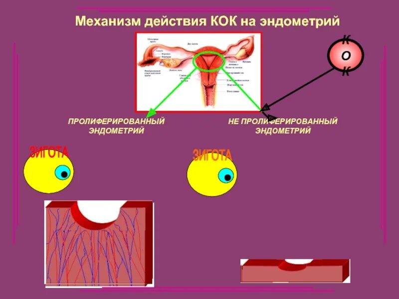 Кок при эндометрии