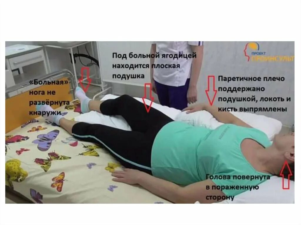 Реабилитация ног после инсульта. Энтезопатия голеностопного сустава. Массаж ног при инсульте. Эквиноварусная деформация стопы после инсульта. Парез руки после инсульта.