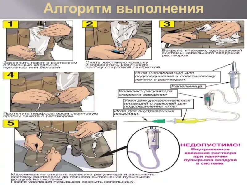Постановка капельницы алгоритм. Техника внутривенного капельного введения жидкости. техника внутривенных капельных вливаний алгоритм. сбор системы для внутривенного вливания алгоритм. внутривенная капельная система алгоритм.