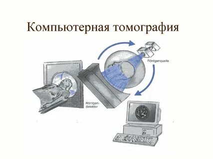 Схема кт