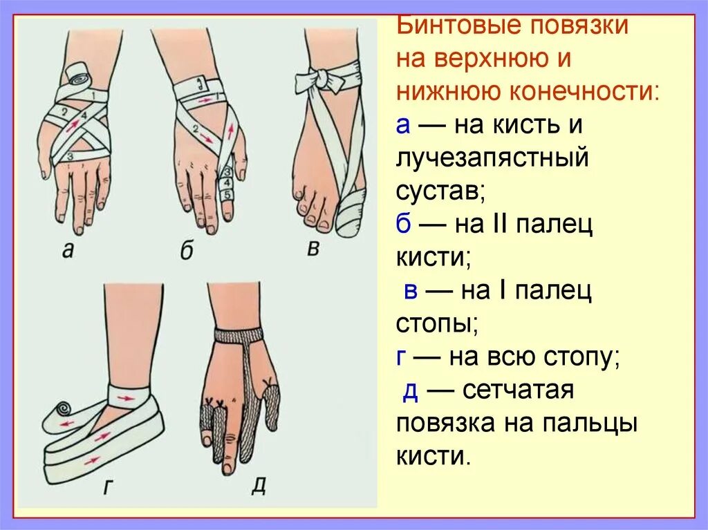 Бинтовая повязка алгоритм. Порядок наложения повязки при ранениях верхних и нижних конечностей. Техника наложения повязок на Верхние конечности. Бинтовые повязки на кисть и верхнюю конечность. Бинтовые повязки на верхнюю конечность.