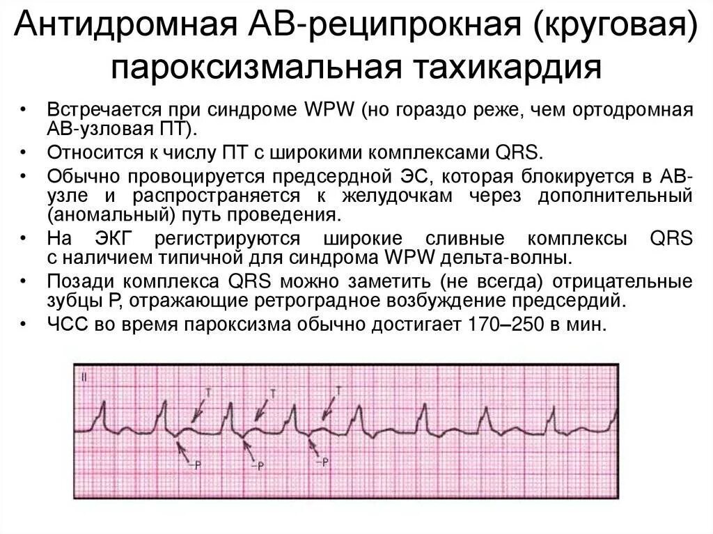 Повышенное сердцебиение после