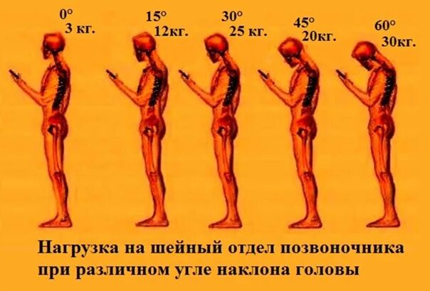 Осевые упражнения на позвоночник. Нагрузка на позвоночник при наклоне головы. Распределение нагрузки на позвоночник. Нагрузка на позвонки при наклоне. Нагрузка на спину.