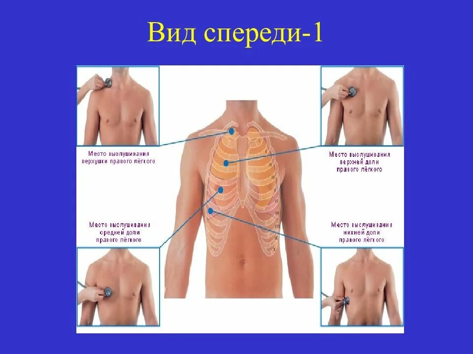 Точка спереди. Аускультация нижней доли правого легкого. Методика аускультации легких. Точки аускультации легких схема. Аускультация легких точки выслушивания.