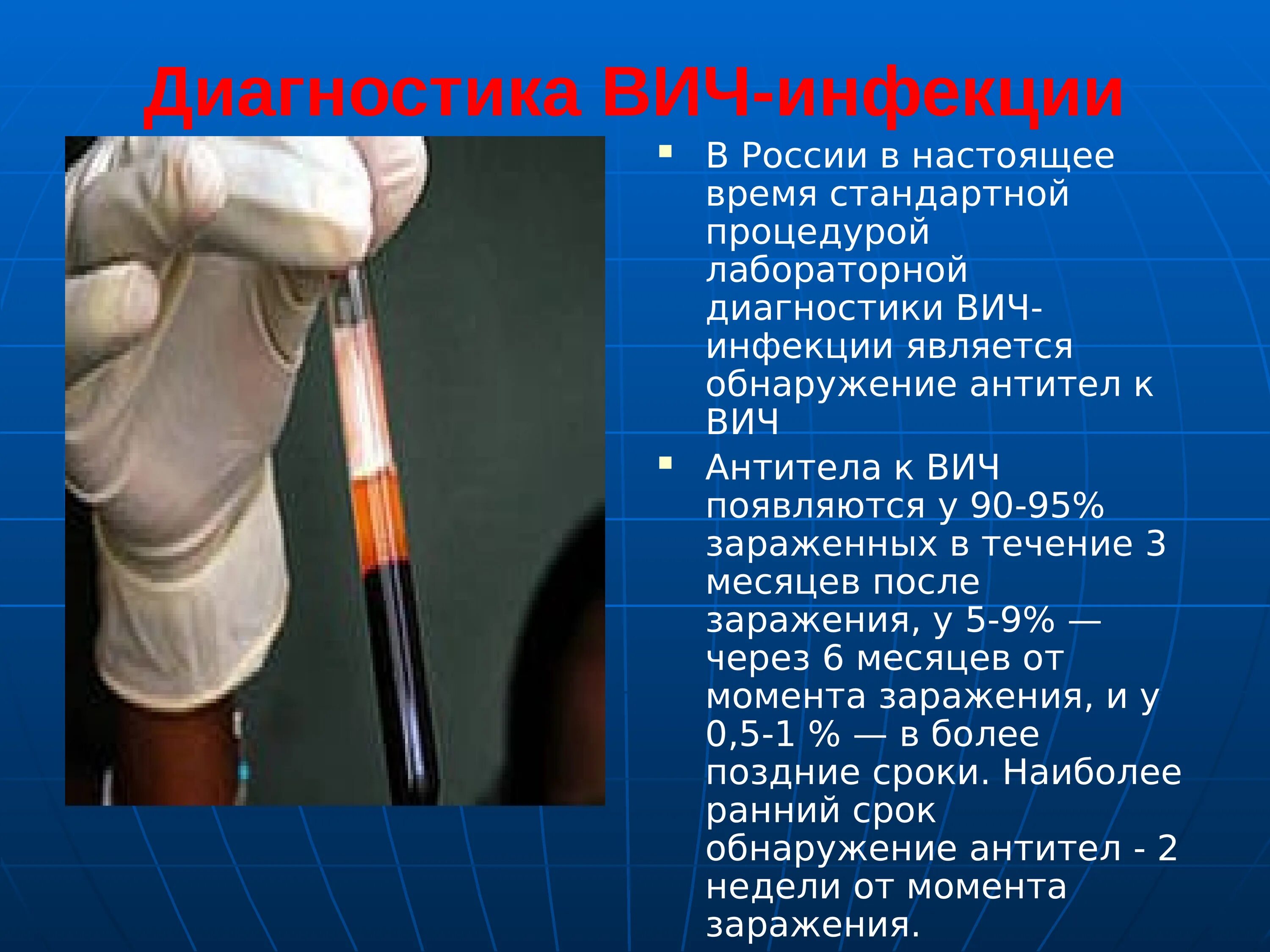 Лабораторная диагностика вич инфекции осуществляется методом определения. Методы диагностики ВИЧ И СПИДА. Методы исследования ВИЧ инфекции. Метод диагностики ВИЧ. Методы определения ВИЧ.