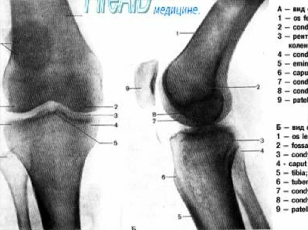 Суставная щель коленного сустава норма. Строение коленного сустава рентген. межсуставная щель коленного сустава. коленный сустав рентген анатомия. суставная щель надколенника.