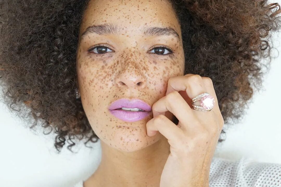 ава кларк девочка альбинос. девушка с необычным цветом кожи.