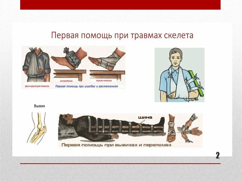 Первая помощь при травмах 8 класс обж. Первая помощь при повреждении скелета. Первая помощь при травмах. Оказание первой помощи при повреждении скелета. Травмы первая помощь при травмах.