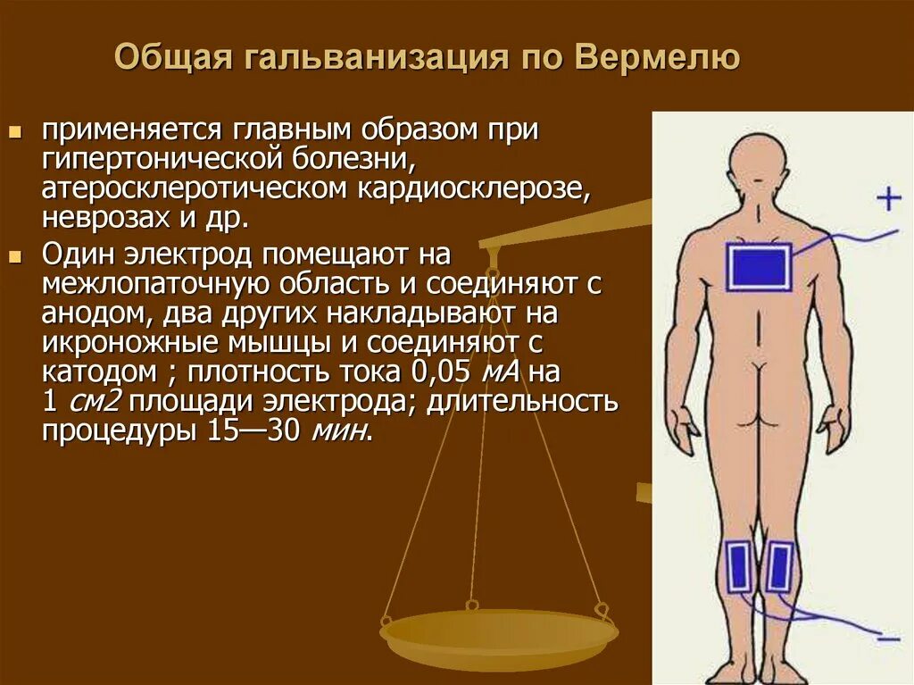 Гальванизация тесты с ответами. Общая гальванизация и электрофорез по вермелю. электрофорез брома по вермелю. методика проведения гальванизации по вермелю. электрофорез по методике вермеля.