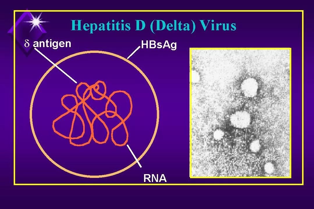 Гепатит д как передается. Гепатит д. Вирус гепатита d. Вирус гепатита Дельта. Структура вируса гепатита д.