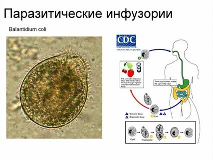 Инфузория балантидий