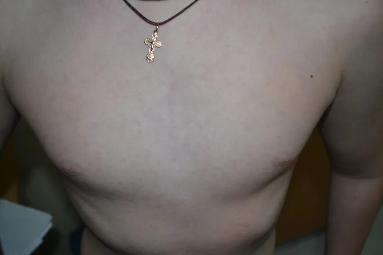 Увеличены лимфоузлы у молочных. Лимфатические узлы молочной железы схема. Интрамаммарный лимфатический узел узи. Интрамаммарный лимфоузел в молочной железе. Лимфоузел на грудной клетке.