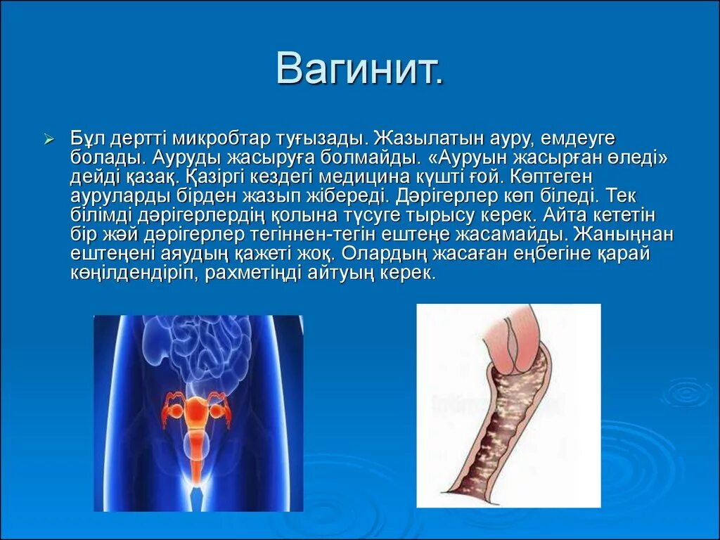 Диагноз вагинит. Фимбо слайды. Су арқылы таралатын ауру картинки.