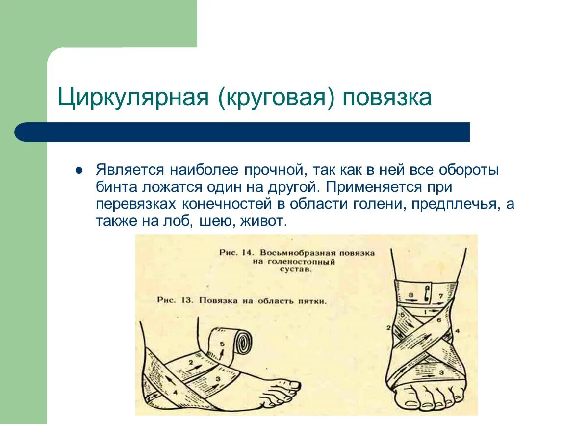 Повязка применяется при ранении. Технология наложения круговой повязки. циркулирующая повязка на конечность. типы бинтовых повязок круговая. циркулярная (круговая) повязка.