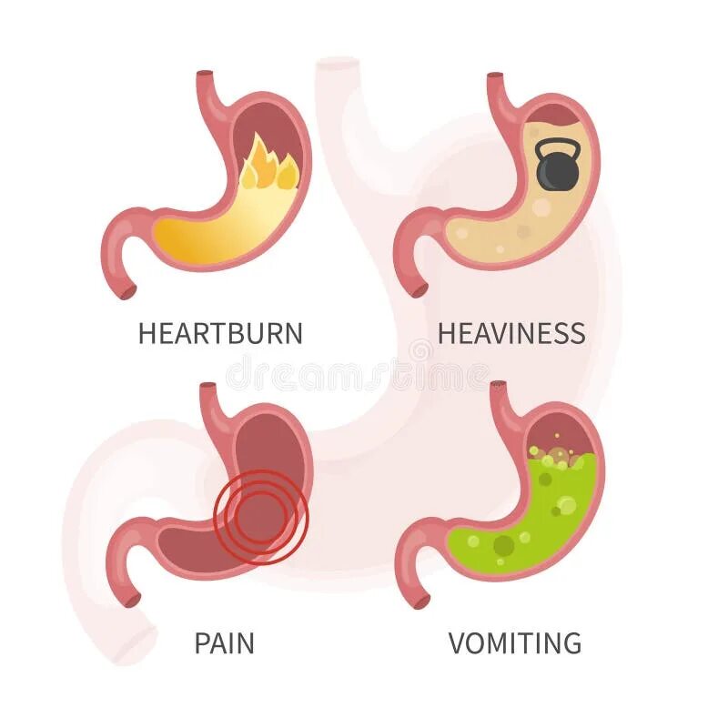 Животе изжога тошнота боли. Желудок рисунок.